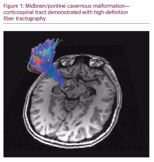 eloquent brain eloquent brain